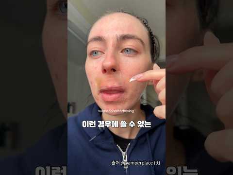 몇 년은 쓰는 가성비 여드름 패치