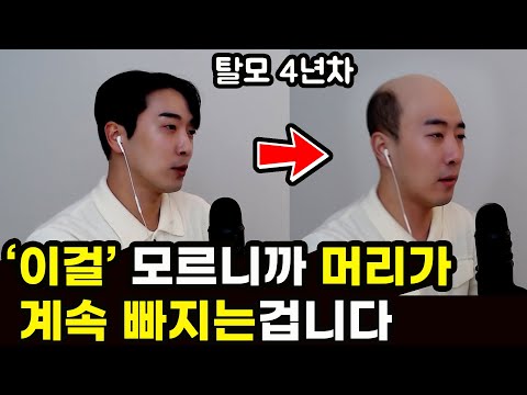 탈모 4년차가 진짜 효과 본 현실적인 방법 3가지 | 남녀 모두 보세요