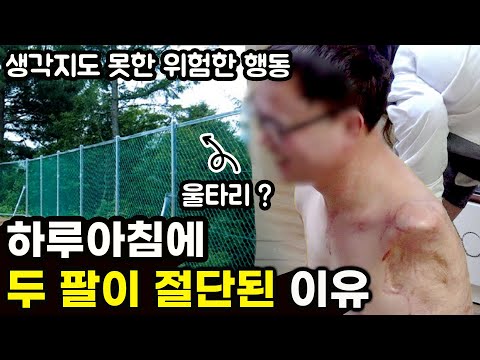 하루 아침에 두 팔이 잘린 이유와 생각지도 못했던 위험한 행동