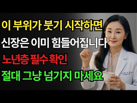 신장병 초기증상은 ‘이 부위’에서 시작됩니다… 무시하면 위험합니다 https://op.opparadise.com/data/apms/video/youtube/xQwWgtylNVE.jpg 신장병 초기증상은 ‘이 부위’에서 시작됩니다… 무시하면 위험합니다